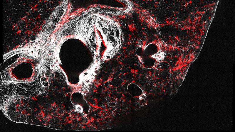 Image de microscope en rouge, blanc et noir